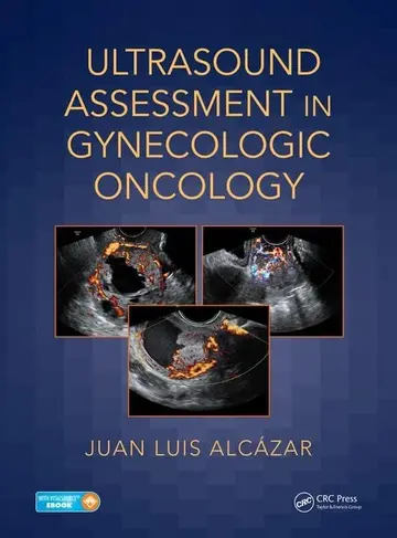 Cover of Ultrasound Assessment in Gynecologic Oncology