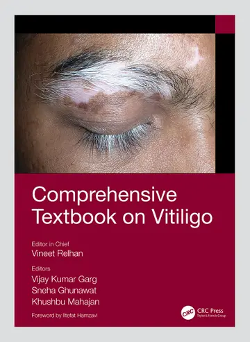 Cover of Comprehensive Textbook on Vitiligo