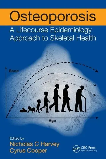 Cover of Osteoporosis