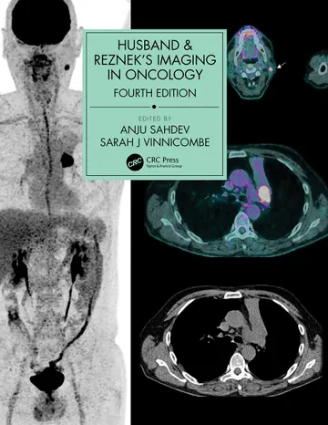 Cover of Husband and Rezneks Imaging in Oncology 4Ed