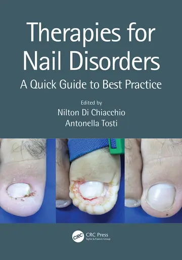 Cover of Therapies for Nail Disorders A Quick Guide to Best Practice