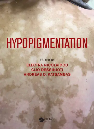 Cover of Hypopigmentation