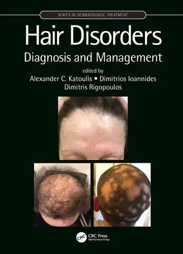 Cover of Hair Disorders Diagnosis and Management