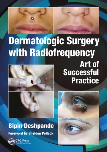 Cover of Dermatologic Surgery with Radiofrequency