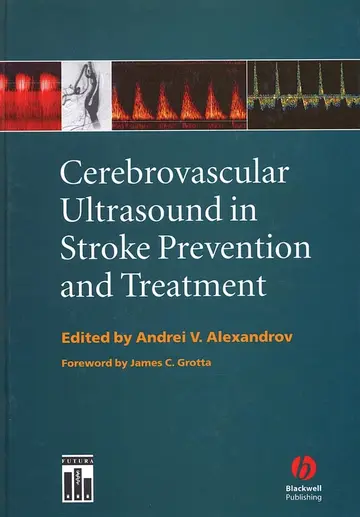 Cover of Cerebrovascular Ultrasound in Stroke Prevention and Treatment