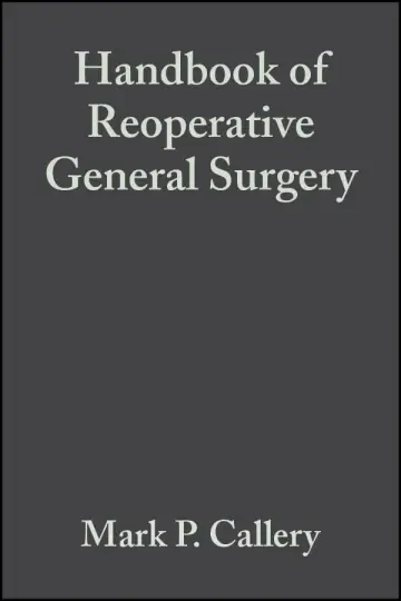 Cover of Handbook of Reoperative General Surgery
