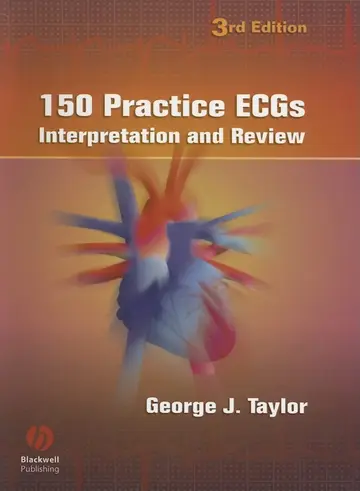 Cover of 150 Practice ECGs