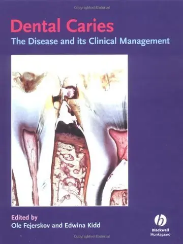 Cover of Dental Caries
