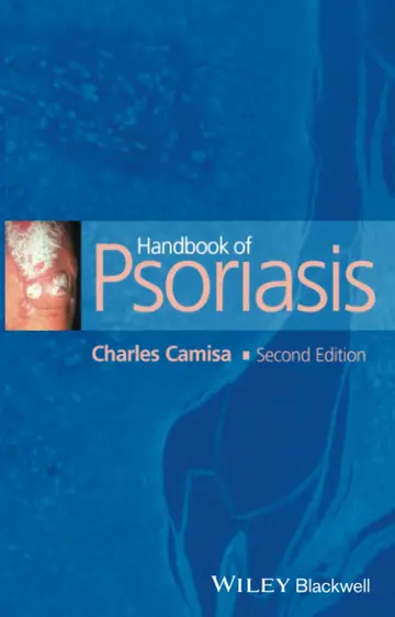Cover of Handbook of Psoriasis