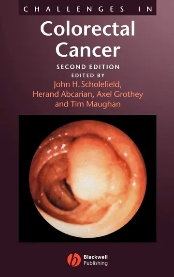 Cover of Challenges in Colorectal Cancer