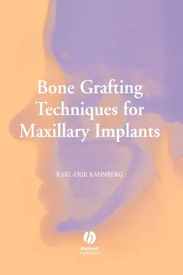Cover of Bone Grafting Techniques for Maxillary Implants