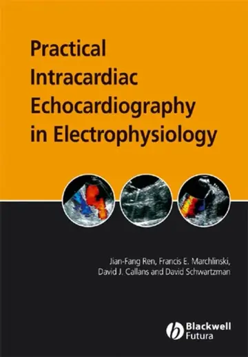 Cover of Practical Intracardiac Echocardiography in Electrophysiology