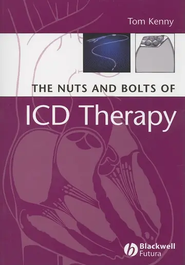 Cover of The Nuts and Bolts of ICD Therapy