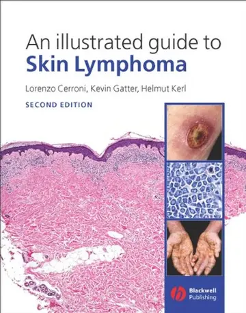 Cover of An Illustrated Guide to Skin Lymphoma