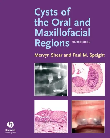 Cover of Cysts of the Oral and Maxillofacial Regions