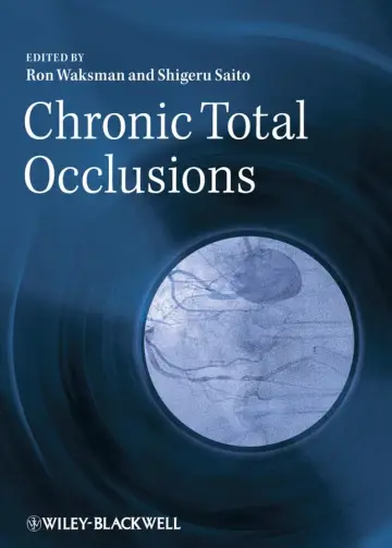 Cover of Chronic Total Occlusions