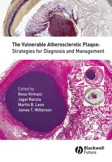 Cover of The Vulnerable Atherosclerotic Plaque