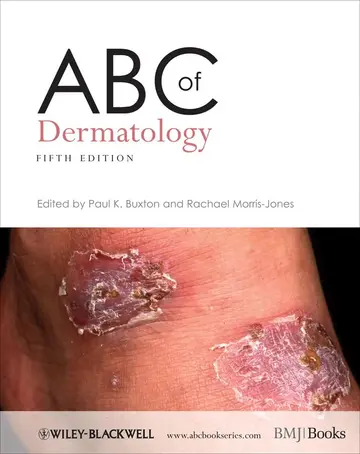 Cover of ABC of Dermatology