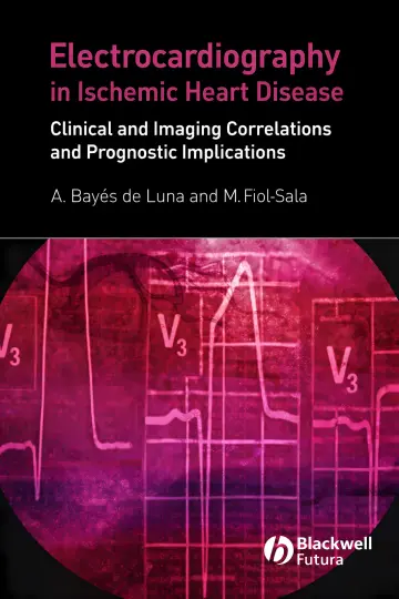Cover of Electrocardiography in Ischemic Heart Disease