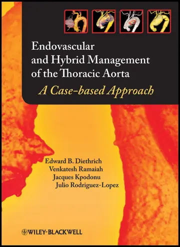 Cover of Endovascular and Hybrid Management of the Thoracic Aorta