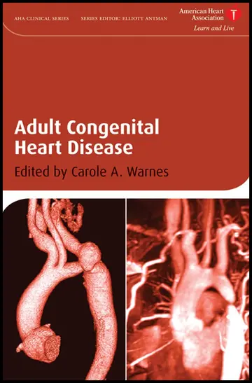 Cover of Adult Congenital Heart Disease