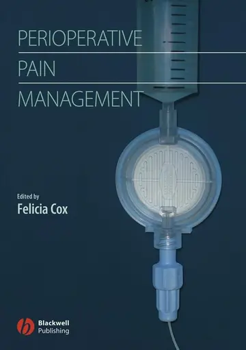 Cover of Perioperative Pain Management