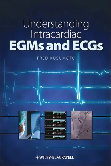 Cover of Understanding intracardiac EGMs and ECG's
