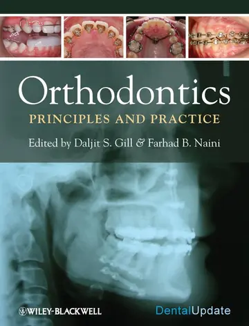 Cover of Orthodontics - Principles and Practice