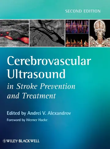 Cover of Cerebrovascular Ultrasound in Stroke Prevention and Treatment