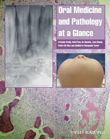 Cover of Oral Medicine and Pathology at a Glance (At a Glance (Dentistry))