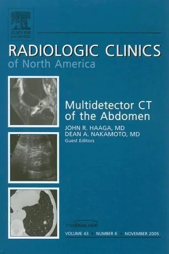 Cover of MDCT of the Abdomen