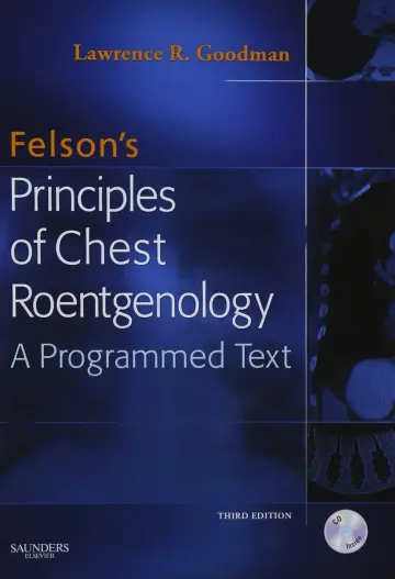 Cover of Felson's Principles of Chest Roentgenology