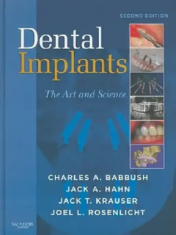 Cover of Dental Implants