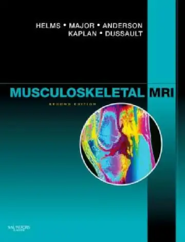Cover of Musculoskeletal MRI