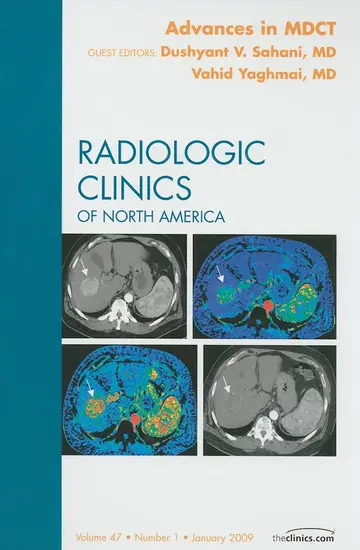Cover of Advances in Mdct