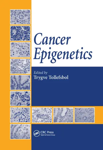 Cover of Cancer Epigenetics