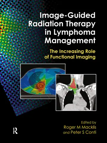 Cover of Image-Guided Radiation Therapy in Lymphoma Management