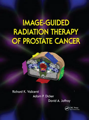 Cover of Image-Guided Radiation Therapy of Prostate Cancer