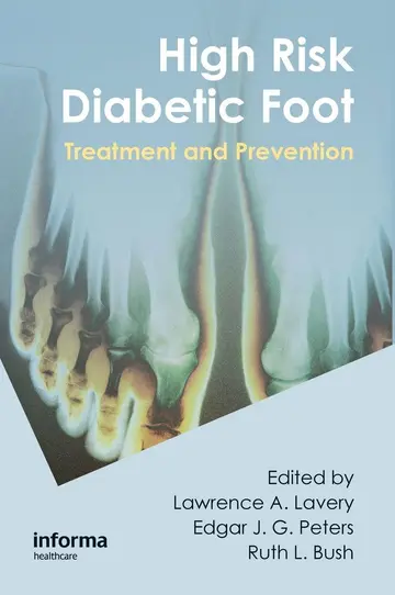 Cover of High Risk Diabetic Foot Treatment and Prevention (Hb 2010) Spl Price