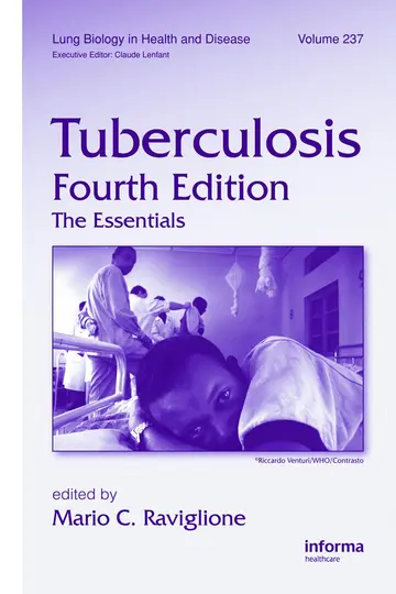 Cover of Tuberculosis