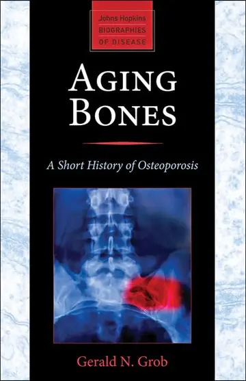Cover of Aging Bones
