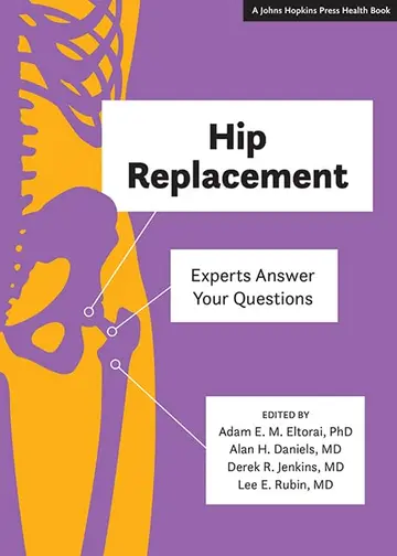 Cover of Hip Replacement