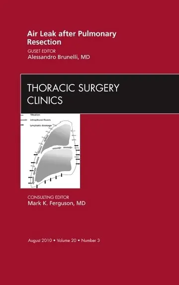 Cover of Air Leak After Pulmonary Resection