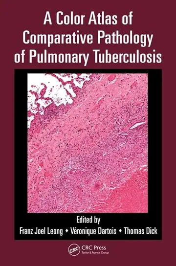 Cover of A Color Atlas of Comparative Pathology of Pulmonary Tuberculosis