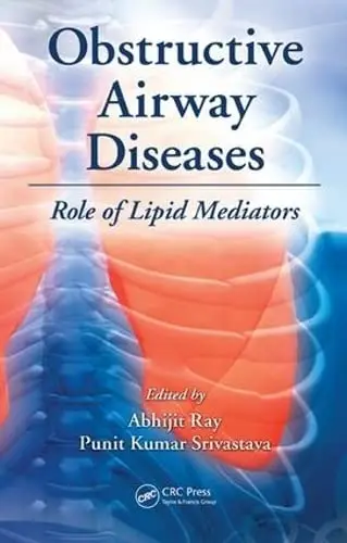 Cover of Obstructive Airway Diseases