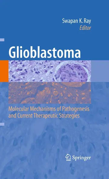 Cover of Glioblastoma