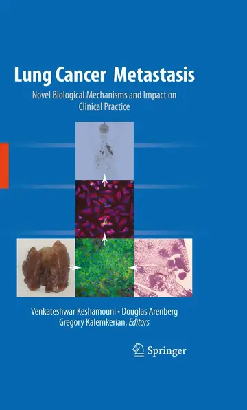 Cover of Lung Cancer Metastasis