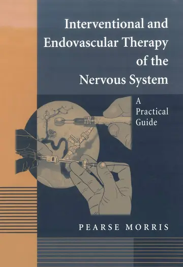 Cover of Interventional and Endovascular Therapy of the Nervous System
