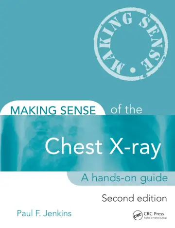 Cover of Making Sense of the Chest X-Ray