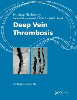 Cover of Practical Phlebology